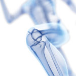 Training to prevent bone loss